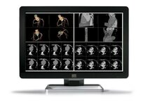 Barco Coronis Fusion 6mp dl - (mdcc-6130) - 30 inch - 6mp - color-lcd - inclusief adapter Barco Coronis Fusion 6mp dl - (mdcc-6130) - 30 inch - 6mp - color-lcd - inclusief adapter